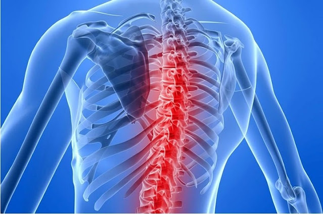 Spinal Muscular Atrophy