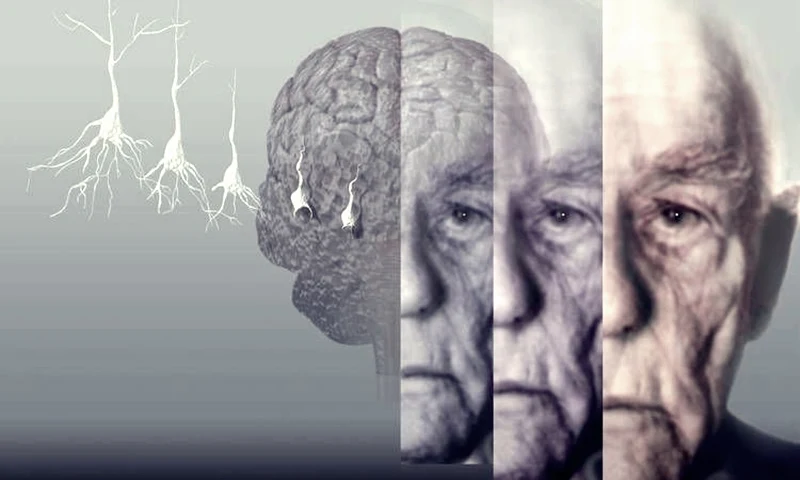 Demans ve alzheimer arasındaki farklar nelerdir?