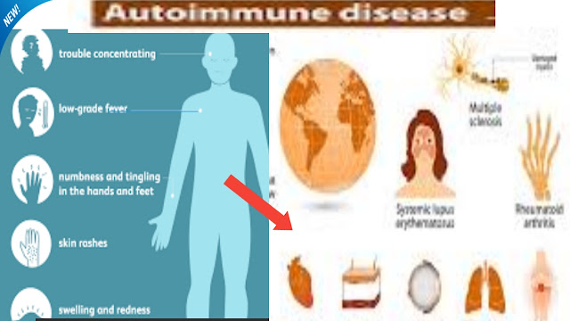 autoimmune diseases,What are the  most common autoimmune diseases?, What are the  autoimmune diseases?, What are the  causes of  autoimmune diseases?,What are some common autoimmune diseases?