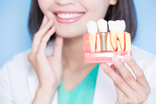 Dental Implant Center in Los Angeles