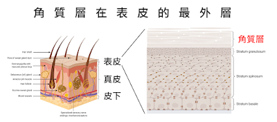 角質層在表皮的最外層，可保護皮膚。濕疹的原因