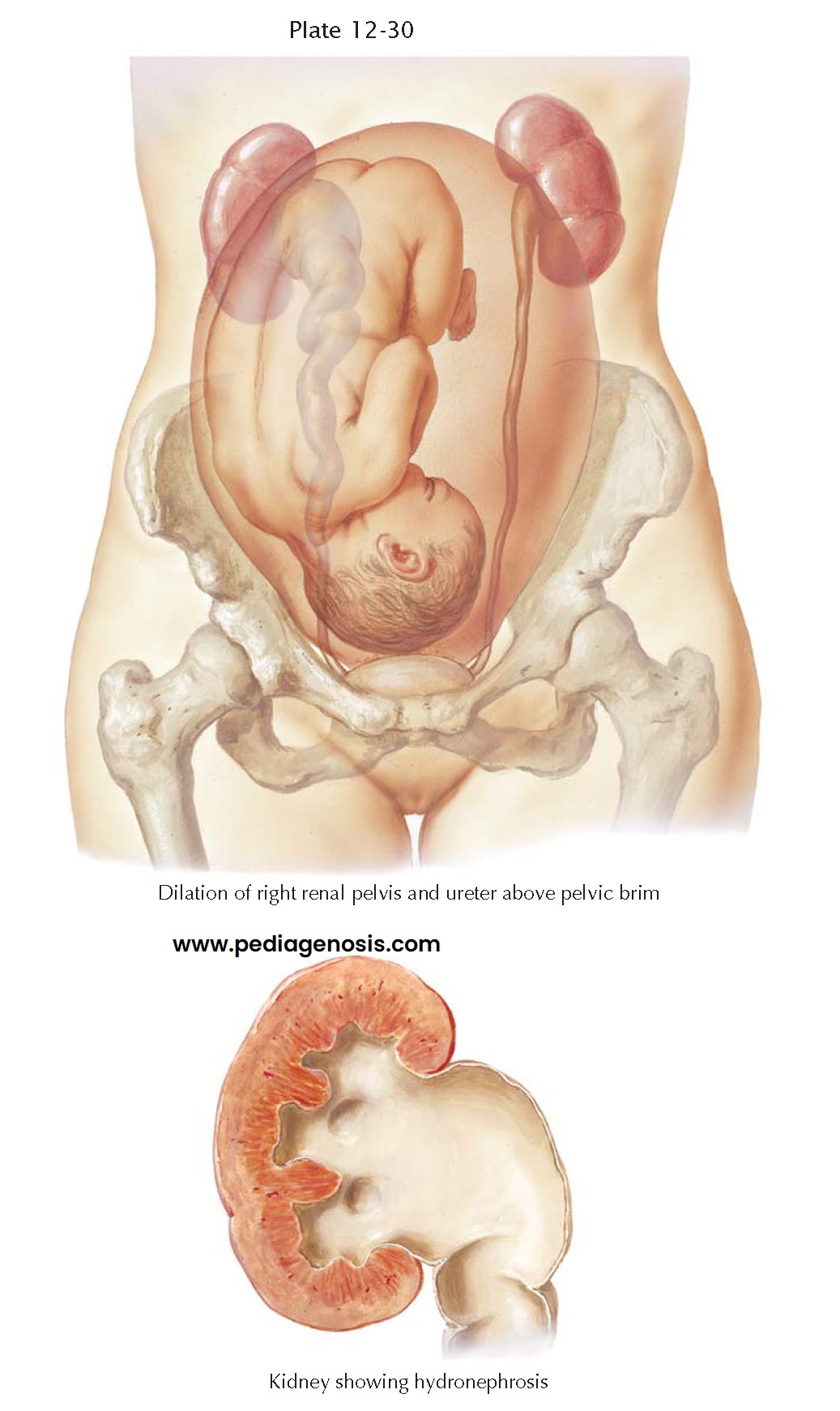 URINARY COMPLICATIONS OF PREGNANCY