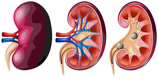 Glomerulonephritis in children symptoms diagnosis treatment