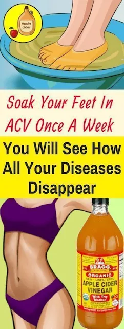 Soak Your Feet In ACV Once A Week – You Will See How All Your Diseases Disappear