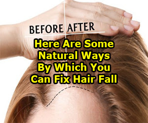 Here Are Some Natural Ways By Which You Can Fix Hair Fall