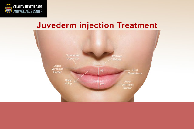 Juvederm injections treatment New Jersey