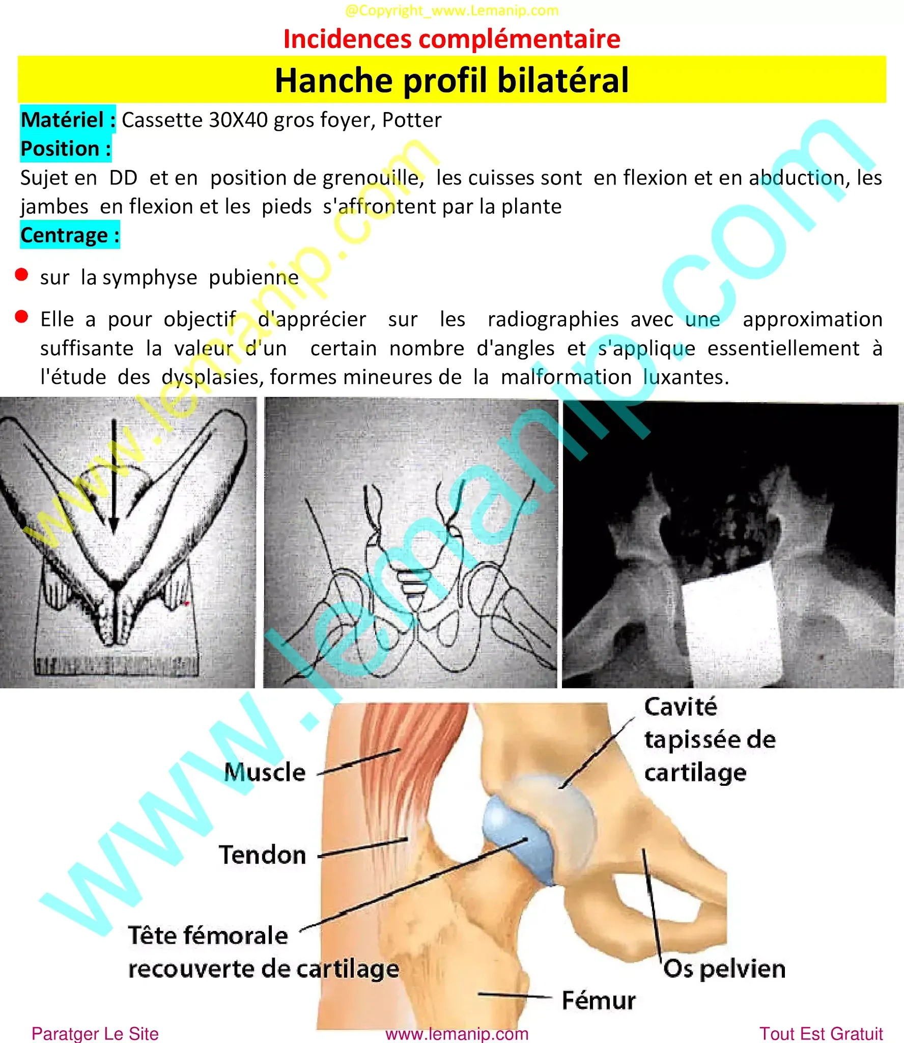 sacrococcygeal joint,pvns,pelvic floor mri,popping hip joint,posterior hip replacement,hip ligaments,rheumatoid,chirurgie hanche clinique privée,douleur hanche et cuisse,chirurgie hanche