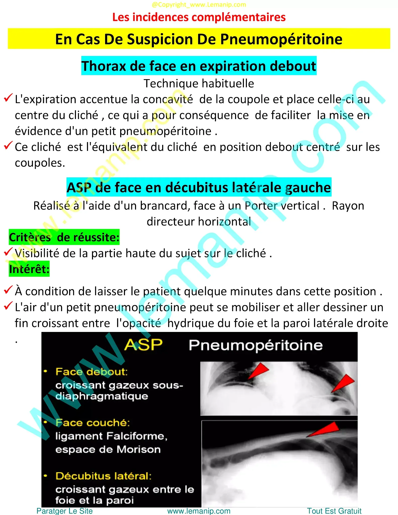 abdominal radiography,abdominal xray,abd xray,belly x ray,x ray on abdomen,xray on abdomen,abdominal xray price,stomach x ray,stomach on xray,pain 2 inches left of belly button after eating,lower back pain that wraps around to abdomen