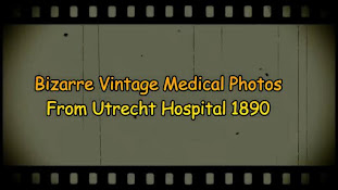 BIZARRE VINTAGE MEDICAL PHOTOGRAPHY FROM UTRECHT HOSPITAL 1890