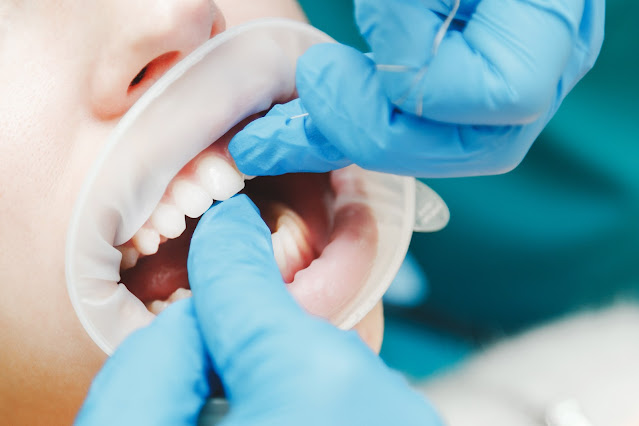 emergency dentist inner west sydney