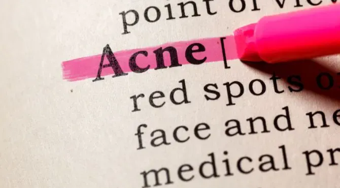 Burdock root benefits for acne