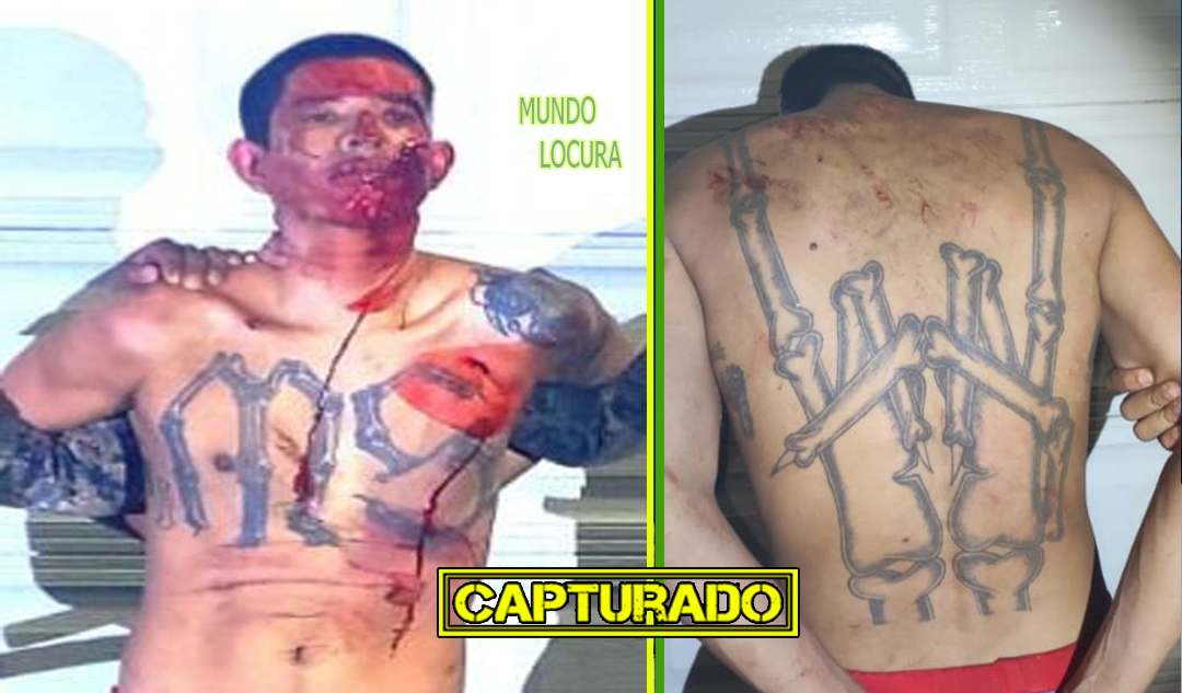 El Salvador: Detienen a alias «Hellboy», pandillero de la MS13 resultó lesionado tras intentar escapar de la Justicia