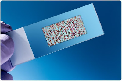 Traditional solid-phase array and alternative bead array are some of the types of DNA microarray.