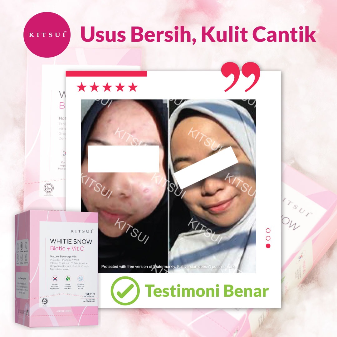 Usus Sihat, Kulit Cerah dan Berseri Dalam 7 Hari Dengan Kitsui Whitie Snow! Kejelitaan Kulit Bermula Dari Dalaman