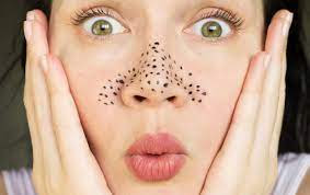 https://khgallery570.blogspot.com/2022/04/what-is-best-way-to-remove-blackheads.html