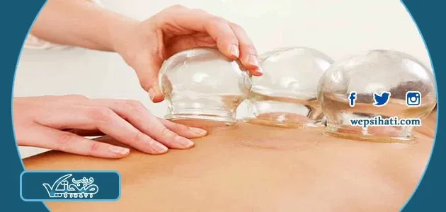 طريقة علاج الخلعة بالتدليك والحجامة الجافة