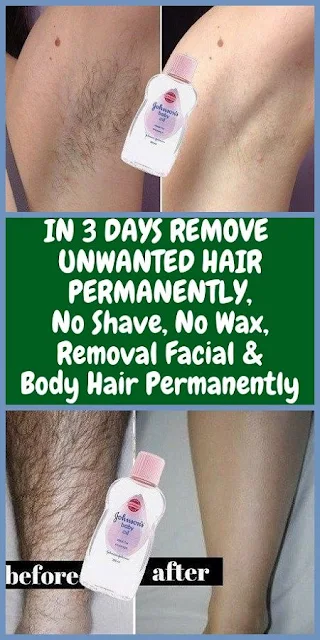 In 3 Days Remove Unwanted Hair Permanently, No Shave No Wax, Removal Facial & Body Hair Permanently !