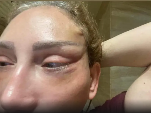 مشاهدة فيديو ريهام سعيد تنهار علي الهواء بعد تشوه وجهها