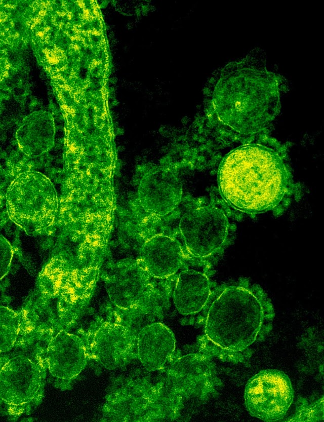 ওমিক্রন: নতুন করোনাভাইরাস ভেরিয়েন্ট  ||  Omicron: About the New Coronavirus Variant