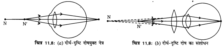 Solutions Class 10 विज्ञान Chapter-11(मानव-नेत्र एवं रंगबिरंगी दुनियाँ)