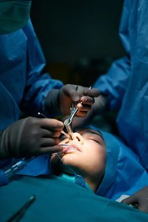 Surgeons performing a delicate procedure nose in an operating room under focused lighting.