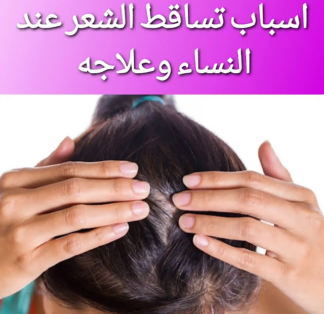 اسباب تساقط الشعر وعلاجه عند النساء