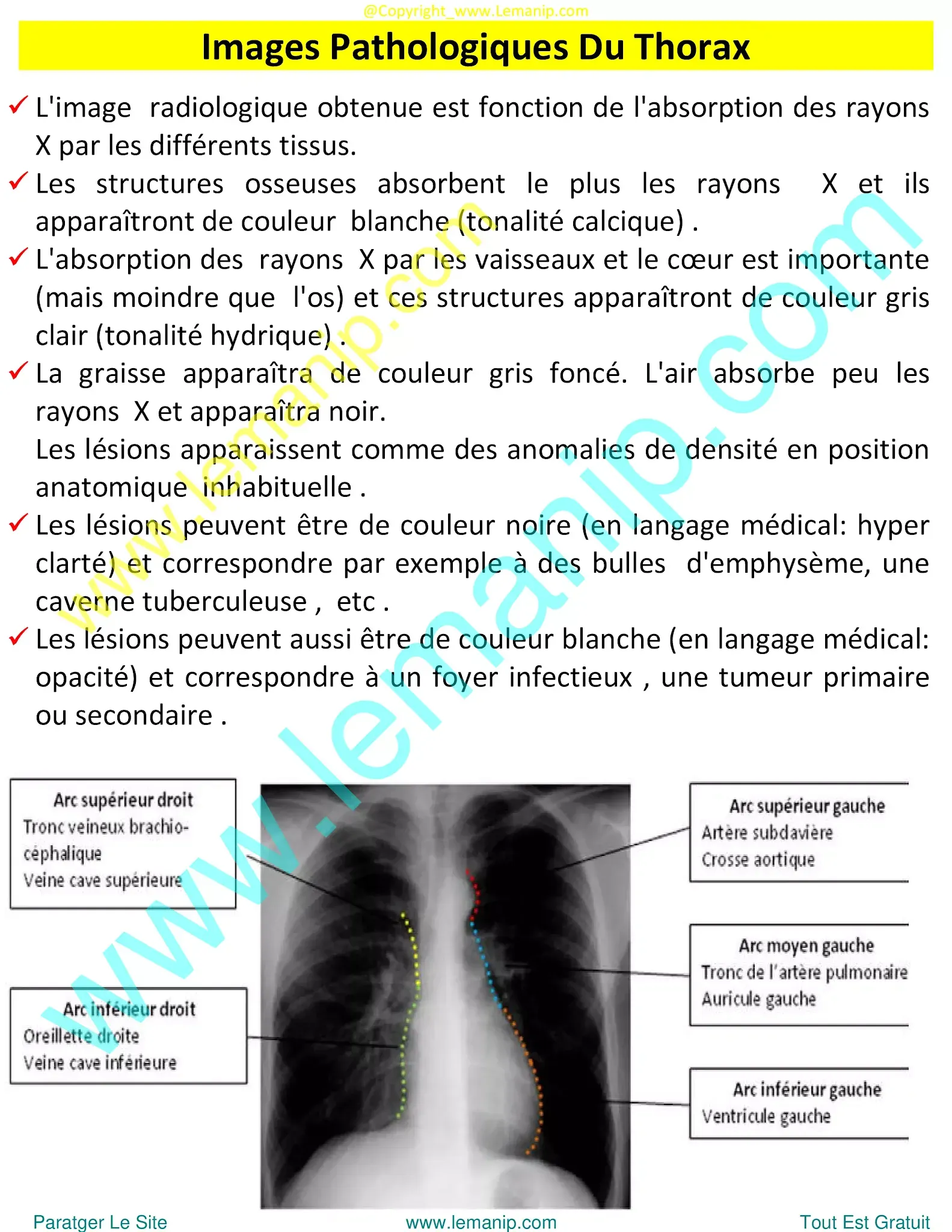 mesothelioma chest x ray,asbestos lung x ray,asthma chest x ray,asthma lungs x ray,urgent care with chest x ray near me,chest xray pa and lateral,ppd chest x ray,chest xray tb,chest x ray pa and lateral,chest xray pa lateral