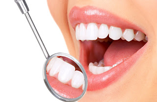 Quy trình tẩy trắng răng-2