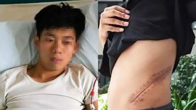 Jual Ginjal untuk Beli iPhone, Pria China Ini Sekarang Harus Cuci Darah Rutin