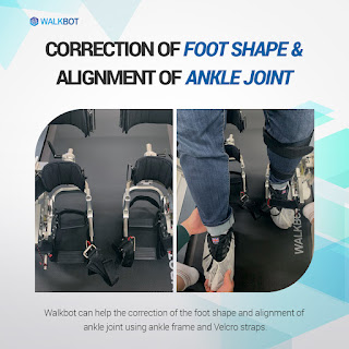 Correction of Foot Shape & Alignment of Ankle joint(1)