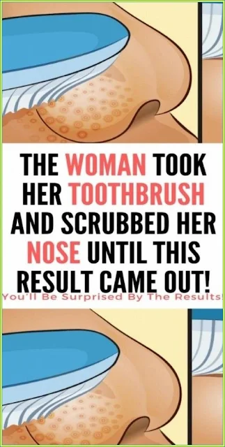 The Woman Took Her Toothbrush And Scrubbed Her Nose Until This Result Came out