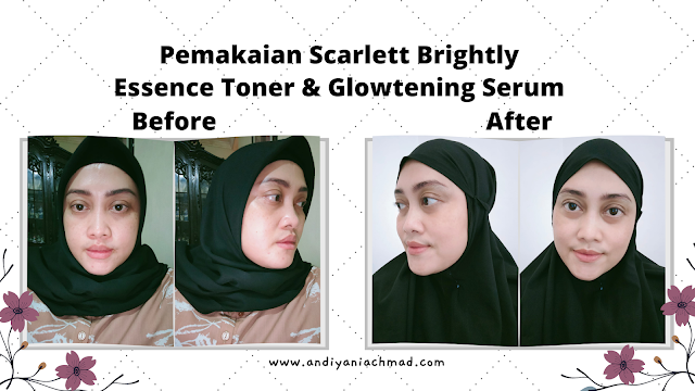 Review Scarlett Brightly Essence Toner dan Glowtening Serum