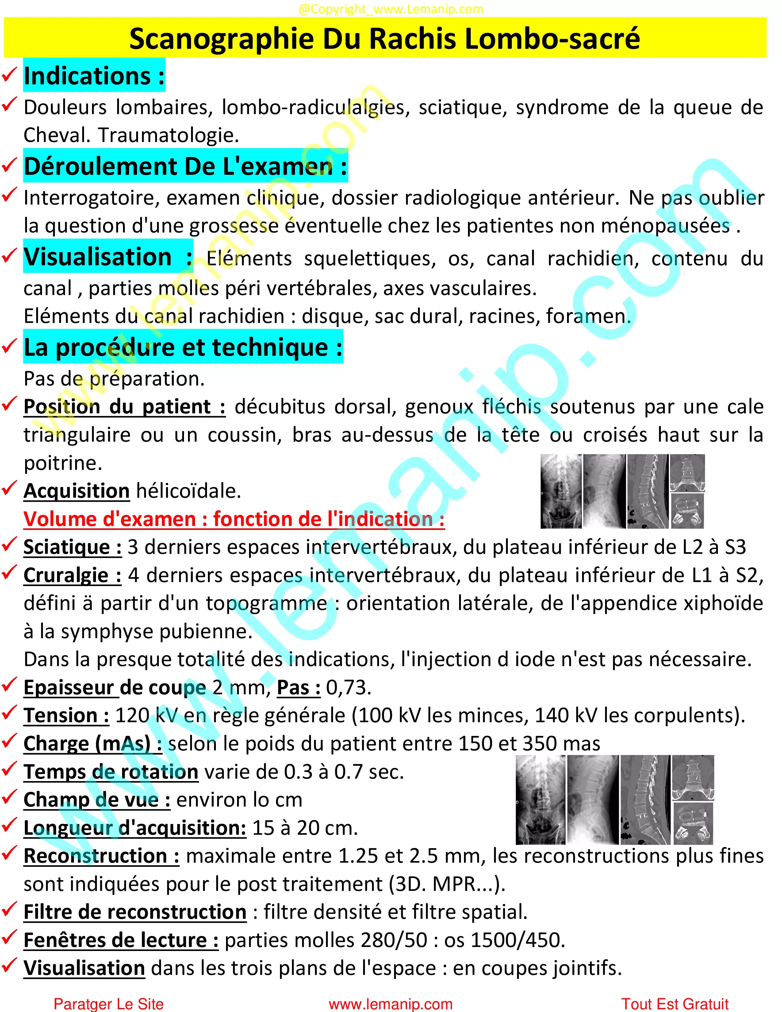 Scanographie Du Rachis Lombo-sacré