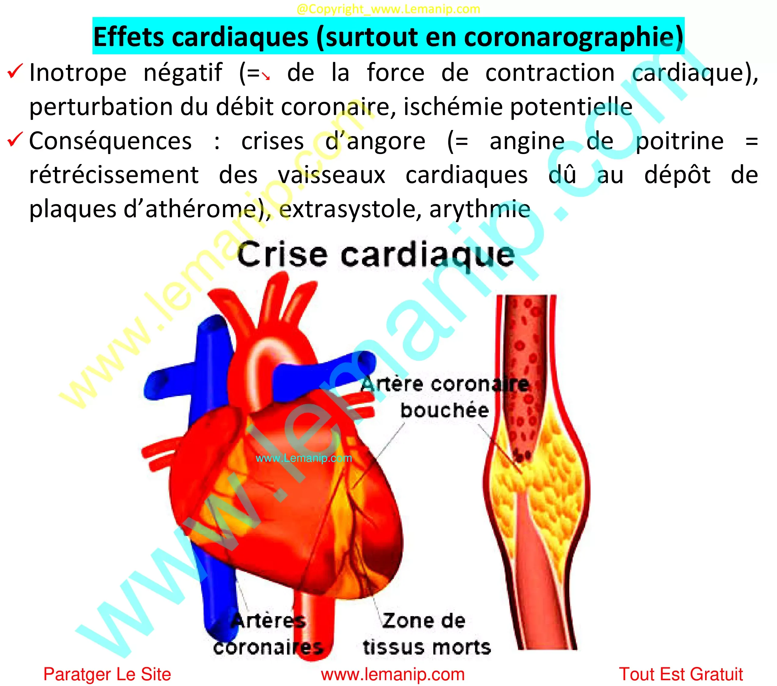 Effets cardiaques (surtout en coronarographie)