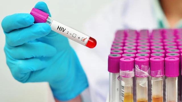 Variante VB: O que sabemos sobre a nova cepa de HIV altamente virulenta encontrada na Holanda