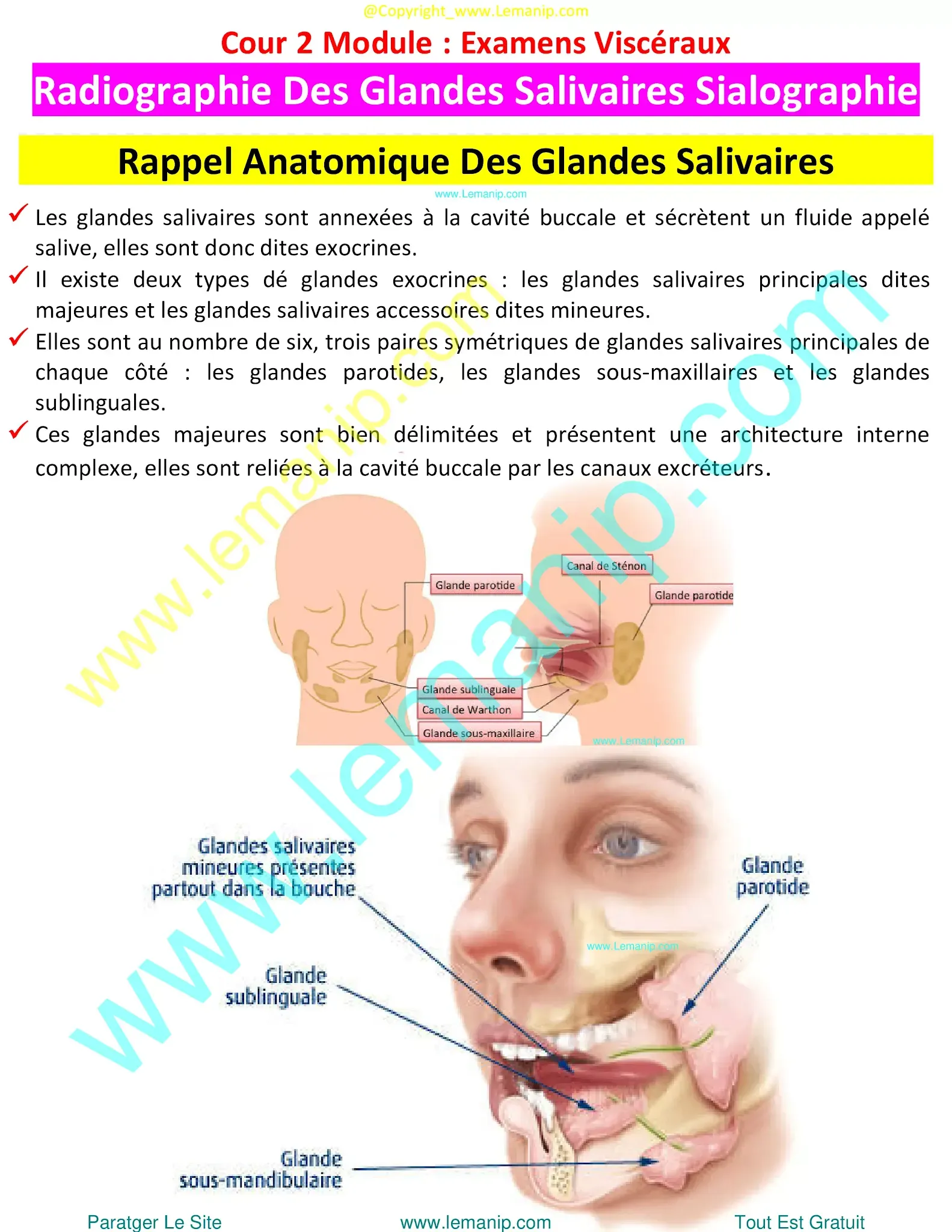 removing salivary gland,sjogren's swollen glands,left parotid,parotid duct,stensen's duct,parotid gland duct,swollen parotid glands both sides,swollen parotid gland on both sides,superficial parotid,inflamed salivary gland