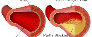 Cholesterol Control Diet and Methods   What is cholesterol?