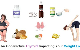 Is An Underactive Thyroid Impacting Your Weight Loss?