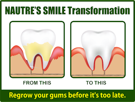 Best Home Remedy for Receding Gums