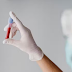 Chega ao Brasil 1º exame de sangue que detecta Alzheimer; como funciona
