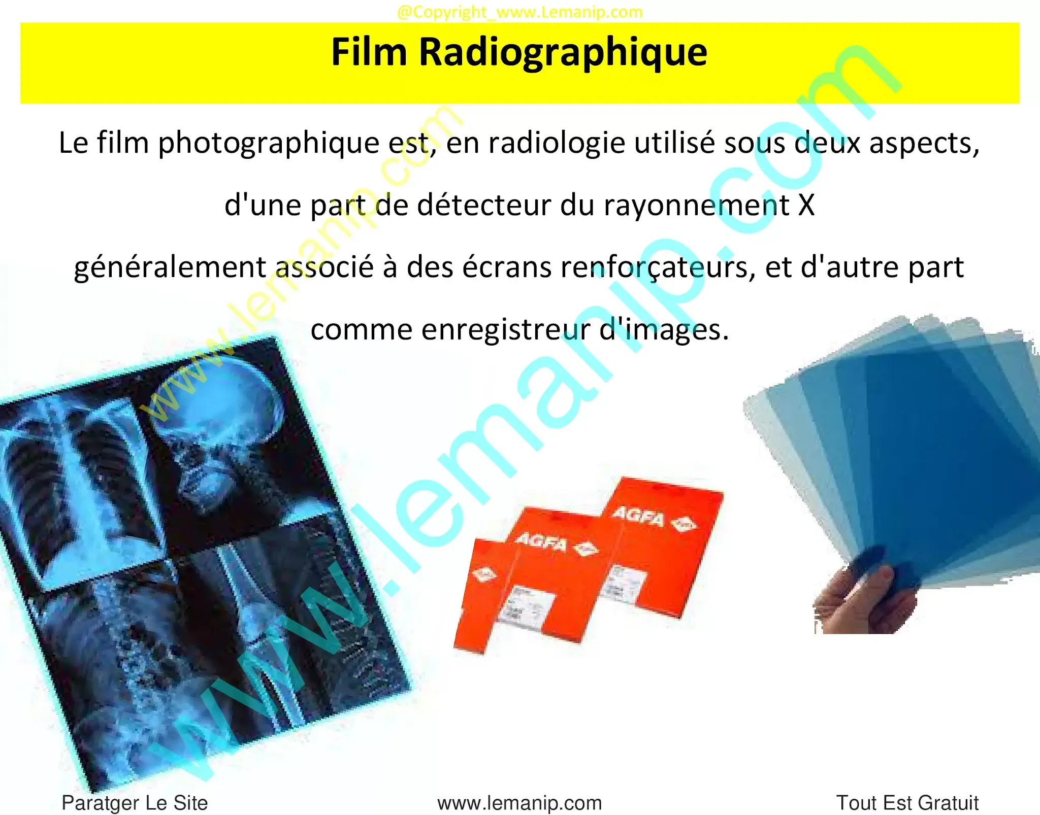 Film Radiographique