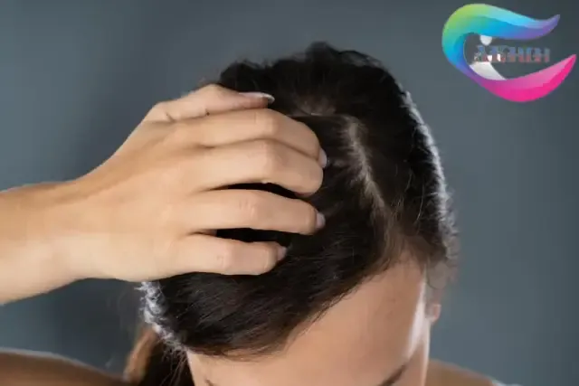 How to moisturize your scalp and take care of it?