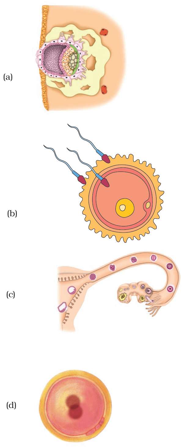 Fig 9.4