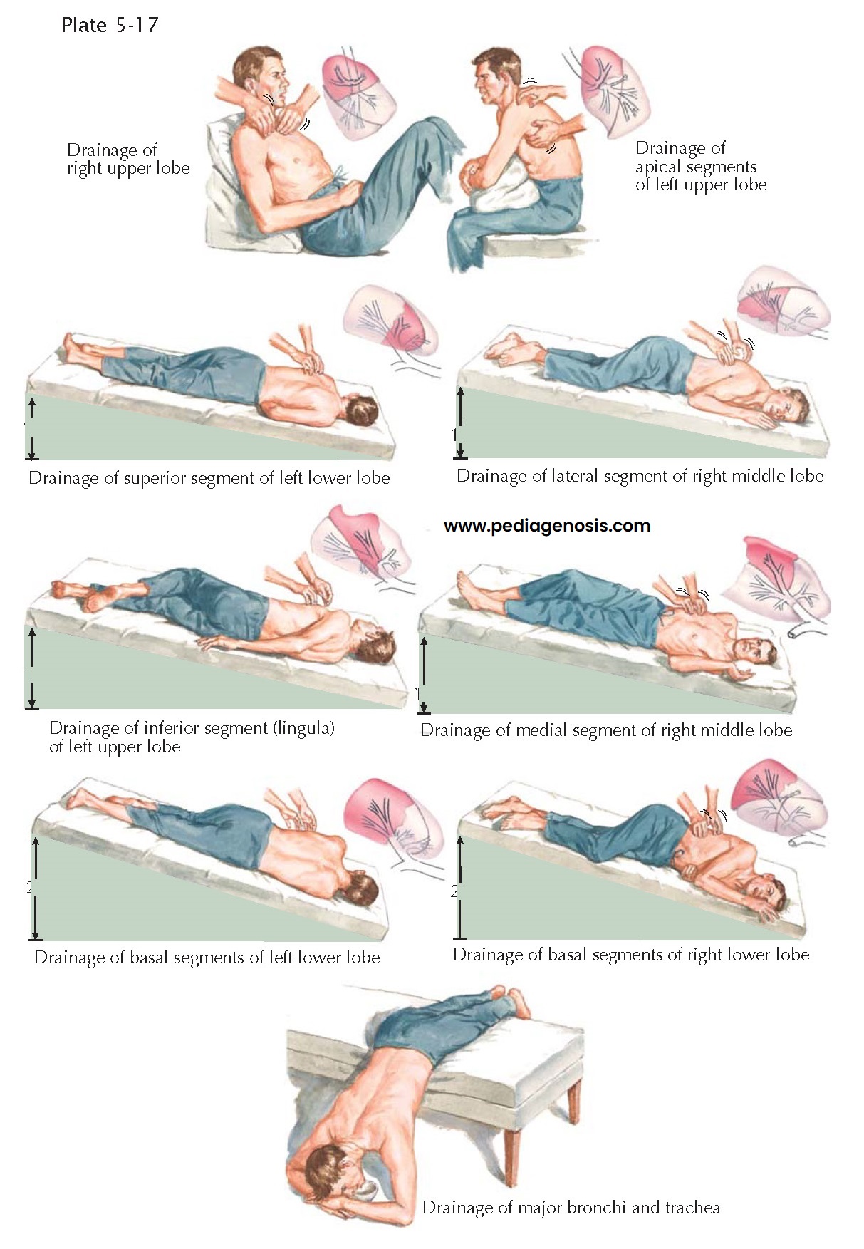 POSTURAL DRAINAGE AND BREATHING EXERCISES