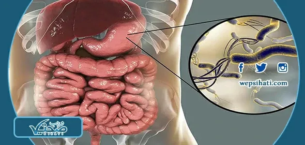 متى تموت جرثومة المعدة