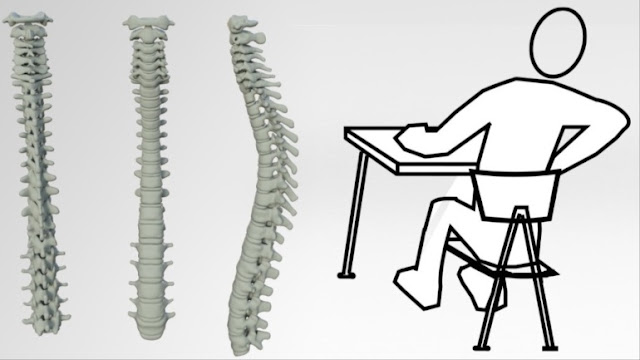 Sitting for a long time causes bad posture for our spine (Pixabi)