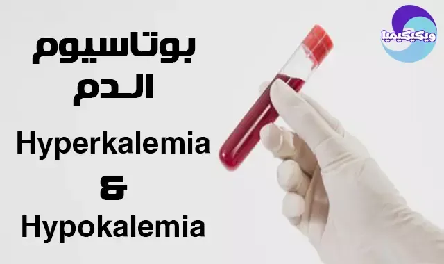 hyperkalemia and hypokalemia