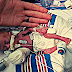 # After This Baby Was Born With One Arm Over His Head, Doctors Gave His Dad Some Frightening News
