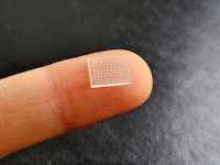 Scientists develop a 3D-printed microneedle patch.