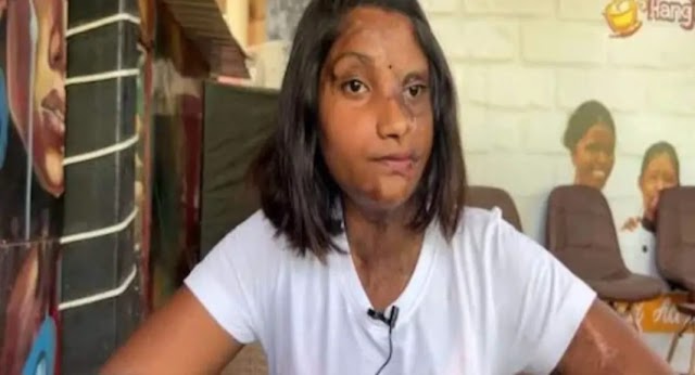 पत्नीणं दुसरं लग्न केल म्हणून पतीने 3 वर्षाच्या मुलीवर केला Acid Attack 